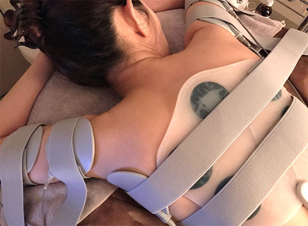 EMSを使っての痩身